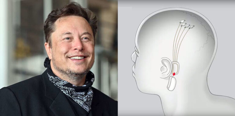 BREAKING: MICROCHIP FOR HUMAN BRAIN IS READY FROM 2022 -ELON MUSK